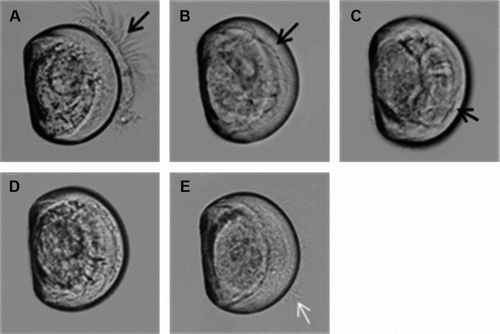 Figure 4  GreenshellTM mussel (Perna canaliculus) larvae (six days old) affected by Karenia brevisulcata during exposure over 24 h to 8.4 × 106 cells L–1. A, Healthy and static, score 4. B, Stressed, the velum started to disintegrate, and cilia withdrawn but healthy and moving, score 3. C, Severely stressed, larvae retracted into shell and cilia moving inside shell, score 2. D, Moribund, cilia gone, larvae disintegrating, still some jerking movement, score 1. E, Dead, disintegrated larvae appeared amorphous, decayed and jelly-like, and cells were being discharged from the dead animal, score 0. Notes: Black arrow in A–C shows cilia and white arrow in E shows leaked tissue.