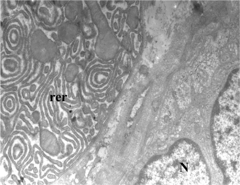Figure 1 Control patient. Acinar cells with very dilated rough endoplasmic reticulum (rer).