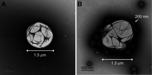 Figure 1 TEM images of microbubble (A) and US-sensitizing nanoparticle complex (NIR-Alb NP complex) (B). TEM images were taken in negative staining.Abbreviation: NIR-Alb NP, near-infrared dye-incorporated albumin nanoparticle; TEM, transmission electron microscopy.