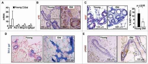 Figure 1. p16 expression is increased in MECs during age-induced senescence. (A) mRNA expression of mammary tissue was analyzed by q-RT-PCR in WT young (2–4-month-old) and old (12–24-month-old) virgin mice. Data are expressed as the mean ± SD from triplicates of each 2 separate mice. (B-E) Representative immunohistochemical staining of p16 (B), Ki67 (C) and γH2AX (E) in 3 mice per group, and SA-β-gal assay in 2 animals per group (D), in mammary glands. The percentages of Ki67-positive cells in (C) were calculated from cells situated in clear duct/gland structure, and the results represent the mean ± SD of 3 animals per group. Note the significant decrease of Ki67-positive cells and strong p16 and SA-β-gal staining in MECs from old mammary glands.