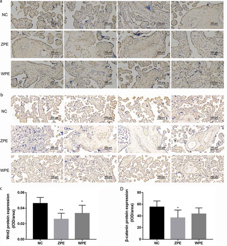 Figure 2. Immunohistochemical staining showed the localization of WNT2 and β-catenin protein in the placental villous tissues of patients with early-onset severe preeclampsia (ZPE group) or late-onset severe preeclampsia (WPE group) compared to that in normal controls (NC group) (200× magnification). A-B: Immunohistochemical staining showed the localization of WNT2 and β-catenin protein in the three groups (N = 6 each group), respectively. C-D: Quantitative analysis of the WNT2 and β-catenin protein expression levels in the three groups according to the mean density (IOD/area value) in each image (N = 6 each group). All experiments were conducted with three biological replicates. Data were expressed as mean ± SD. * P < 0.05 compared to NC group.