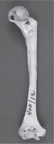 Figure 6. Healed fracture of a left proximal humerus (posterior view). Young woman. First or middle part of New Kingdom (c. 1539–1075 BC). Reprinted with permission from Laboratory of Biological Anthropology, University of Copenhagen.