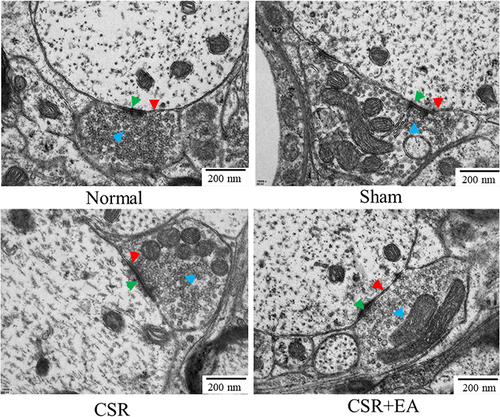 Figure 7 EA alleviated the ultrastructural changes of the synapse in the spinal dorsal horn under CSR.