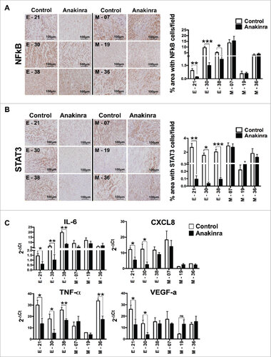 Figure 4. IL-1R antagonist reduces NF-κB p65 and STAT3 phosphorylation in only K-Raspancreatic tumors with epithelial phenotype. Representative immunohistochemistry image of tumors from epithelial cell lines (E-21, E-30, E-38) and mesenchymal cell lines (M-7, M-19, M-36) treated or not with Anakinra as detailed in the legend of Fig. 3. (A) NF-κB p65 phosphorylation, and (B) STAT3 phosphorylation (Tyr 705). Scale bar = 100 mm. Graphs at right side indicate quantification of stained area. Bars indicate  mean +/-SD  of 5 sections/tumor, 3–5 tumors per group). Student's t test #P<0.05, ##P<0.01, ###P<0.001. (C) mRNA expression level of inflammatory mediators in the tumor microenvironment by real-time qPCR. Bars, mean +/-SD. #P<0.05, ##P<0.01 for difference between control and Anakinra treated group.