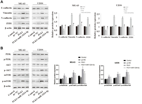 Figure 6 Overexpression of PLK1 inhibits the effect of miR-1224-5p on the expression of related proteins of PI3K/AKT/mTOR and EMT. After transfection of pc-NC, PLK1 and miR-1224-5p mimic+PLK1, the expression levels of EMT-related proteins E-cadherin, Vimentin, N-cadherin, ZEB1 (A) and PI3K/AKT/mTOR signal pathway-related proteins p-PI3K, p-AKT, p-mTOR, PI3K, AKT and mTOR (B), in MG-63 cells and U2OS cells were detected by Western blot. *P < 0.05 vs mi-NC group; #P<0.01 vs PLK1 group.