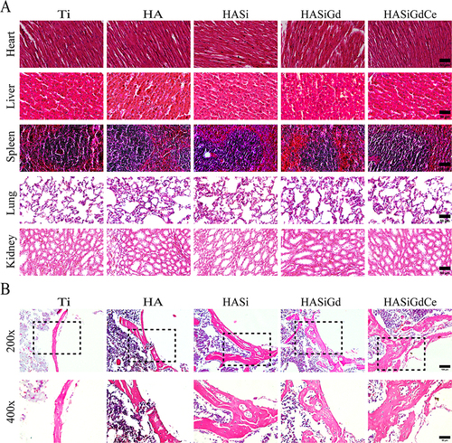 Figure 9 (A) H&E staining images of the heart, liver, spleen, lungs and kidneys of rats, scale bar: 50 μm. (B) H&E staining images of different groups of bone tissue, scale bar: 100 μm / 50 μm.