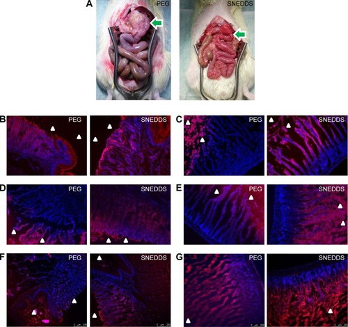 Figure 4 Fluorescence imaging of stomach and intestine of rats after oral administration of Nile red-containing PEG 400 solution and SNEDDS.Notes: (A) Macroscopic observation of GI tract exposed outside the abdominal cavity after oral administration of PEG 400 and SNEDDS in RYGB rats. The arrows indicate the connection of gastric pouch to the Roux limb. (B) Microscopic observation of stomach (100×) after oral administration of PEG 400 and SNEDDS in normal rats. (C) Microscopic observation of intestine (100×) after oral administration of PEG 400 and SNEDDS in normal rats. (D) Microscopic observation of stomach (100×) after oral administration of PEG 400 and SNEDDS in RYGB rats. (E) Microscopic observation of intestine (100×) after oral administration of PEG 400 and SNEDDS in RYGB rats. (F) Confocal imaging of stomach (100×) after oral administration of PEG 400 and SNEDDS in RYGB rats. (G) Confocal imaging of intestine (100×) after oral administration of PEG 400 and SNEDDS in RYGB rats. Triangles in (B–G) indicate the lumens.Abbreviations: RYGB, Roux-en-Y gastric bypass; PEG, polyethylene glycol; SNEDDS, self-nanoemulsifying drug delivery systems.