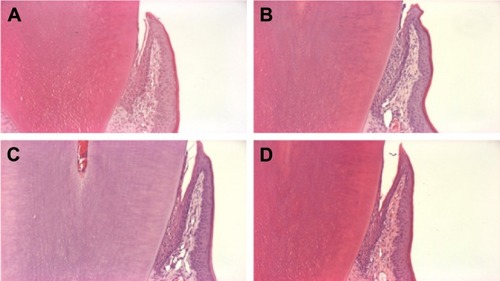 Figure 5 Histological observation of the gingival gingiva.