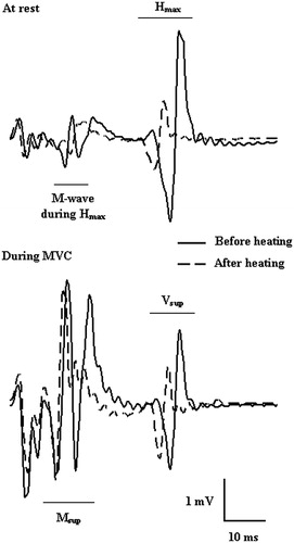 Figure 1. An example of reflexes at rest and during maximal voluntary contraction (MVC) before and after passive body heating (original data obtained from one participant).