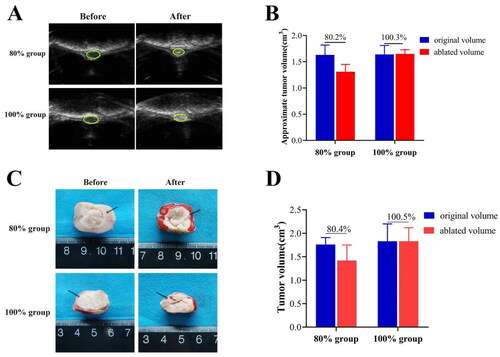 Figure 1. (A) B-mode ultrasonography images of VX2 breast tumor areas in each group before and immediately after HIFU ablation. After ablation, the sonographic images of each group showed obvious enhancement of tumor echo; (B) Quantitative calculation of approximate tumor volume before and after ablation by B-ultrasonography; (C) Observation of the extent of coagulation necrosis in each group. (D) Quantitative calculation of tumor volume in two group by TTC staining (n = 5, *p < 0.05, **p < 0.001).