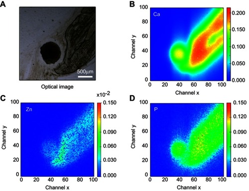 Figure 8 cHA microspheres implanted for 6 months in rat calvaria (region 2). (A) Optical image, (B–D) Ca, Zn and P SR-µXRF elemental mapping.Abbreviations: cHA, carbonated hydroxyapatite; SR-µXRF, Synchrotron radiation-based X-ray microfluorescence.