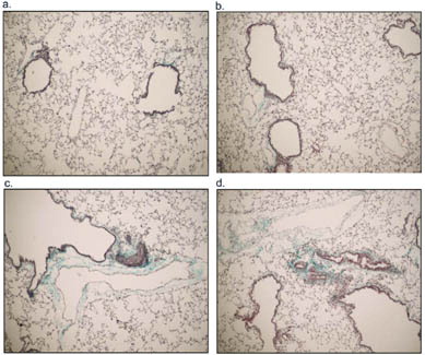 2 Representative examples of Gomori trichrome staining of (a) saline, (b) acid-washed PM 1648, (c) PM 1648, and (d) PM2.5 exposed NZM mice 17 weeks following exposure. The PM 1648 and PM2.5 exposed NZM mice showed increases in fibrosis and collagen deposition represented by the blue staining of collagen. Saline exposed NZM mice had minimal collagen deposition.