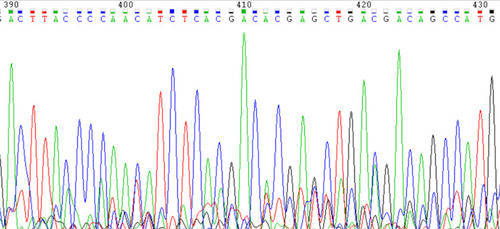 Figure 2 Partial Sanger sequencing peak map of the 16S rDNA PCR product of the isolate sequenced with the 1492R primer.