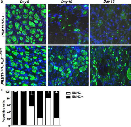 FIG 6 Adult PRMT1FL/FL; Pax7CreERT2/+ mice have impaired muscle regeneration following cardiotoxin-induced injury. (A) (Left) Representative images of injured or uninjured tibialis anterior (TA) from PRMT1FL/FL; Pax7CreERT2/+ and PRMT1FL/FL; − mice extracted 21 days after Ctx injection. The injured TA muscles were cryosectioned at the cross-section area (CSA) (lower images, top left corner), which was measured using nine mice of each genotype. White bar, 100 μm; black bar, 1 cm. (Right) For each mouse, five cross sections were analyzed and the average was calculated to be representative of the samples. (B) The injured TA muscles of the indicated genotypes were cryosectioned, freshly fixed, and immunostained for Pax7 and laminin to assess regeneration. (C) (Left) Quantification of the Pax7-positive cells per fiber after regeneration in PRMT1FL/FL; Pax7CreERT2/+ and PRMT1FL/FL; − mice TA cross sections; (right) representative image from Pax7CreERT2/+ and PRMT1FL/FL; − TA section after regeneration to show a hot spot of proliferative Pax7-positive cells. (D) Injured TA cross sections from PRMT1FL/FL; Pax7CreERT2/+ and PRMT1FL/FL; − mice extracted at days 5, 10, and 15 after Ctx injection. Injured TA were cryosectioned at the cross section area and stained for embryogenic myosin heavy chain (EMHC) to index regeneration. For each time point, three mice of each genotype were used. (E) Quantification of the EMHC-positive and -negative regenerating fibers in PRMT1FL/FL; Pax7CreERT2/+ and PRMT1FL/FL; − TA cross sections. For each time point, three mice of each genotype were used. For each sample, analysis was performed using the average of positive/negative EMHC fibers from three pictures to be representative of the sample. **, P < 0.01; ***, P < 0.001.