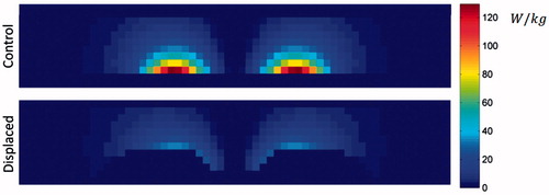 Figure 7. SAR distribution for control and displaced phantoms. Cross-sections shown at y = 0 cm.