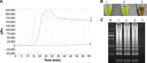 Figure 2 Examination of the products of LAMP for detecting the Pneumocystis jirovecii gene.