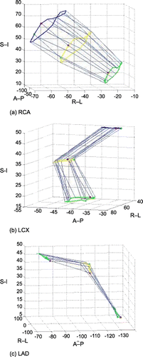 Figure 2. Trajectory of three vessels. (a) RCA, (b) LCX, (c) LAD. Blue, yellow and green circle represents the motion of the coil at 2.5 cm, 5.0 cm and 7.5 cm away from the aortic root respectively. Red dots represents the first phase of cardiac cycle and green one the last. (View this art in color at www.dekker.com.)