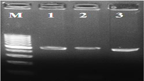 Figure 2 PCR products were run on 2% agarose gel. Lane M 100bp DNA Marker. Lane 1: amplified PCR product of fragment one (520 bp). Lane 2: amplified PCR product of fragment 2 (532 bp). Lane 3: amplified PCR product of fragment 3 (476bp).