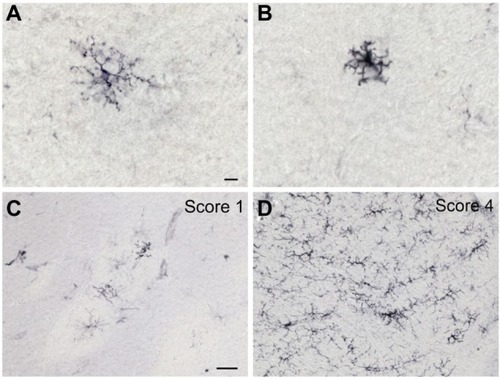 Figure 1 HLA-DR-ir microglia morphology and semiquantitative rating. Representative high magnification images of HLA-DR-positive resident (A) and activated (B) microglia. Characteristic images of HLA-DR-ir nigral sections showing a score of 1 (C) and 4 (D) on a rating scale of 0–4 defining the presence of activated microglia. Scale bar: (A and B) =10 μm; (C and D) =50 μm.Abbreviations: HLA, human leukocyte antigen; ir, immunoreactivity.