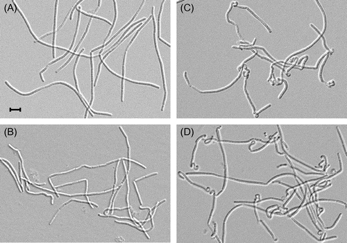 Fig. 5. Cell morphology of yqgA mutants.Notes: Cells were cultured same as in Fig. 4, and harvested at the period at OD600 = 0.01. Cell morphology was observed by differential interference microscopy. (A) EF, (B) 168-∆YQ, (C) EF-YQGAd, and (D) EF-∆YQ. The black bar indicates 5 μm. Cells with a truncated or null yqgA mutation on a lytE and lytF mutant background (EF-YQGAs and EF-∆YQ) often displayed a heavily twisted cell morphology.