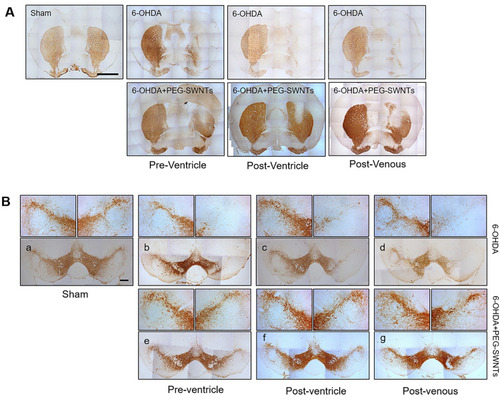 Figure 3 Histological assessment of PEG-SWNTs injected PD animals. (A) Immunohistochemistry staining for TH+ neurons in the ST two weeks after 6-OHDA injection. Scale bar = 1 mm. (B) Immunohistochemistry staining for TH+ neurons in the SN pars compacta (SNpc) two weeks after 6-OHDA injection. Scale bar = 200 µm.