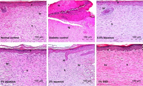 Figure 7 Hematoxylin–eosin histological sections of excisional wound site obtained from a diabetic wound treated with silver sulfadiazine (SSD).