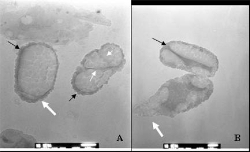 Figure 7 TEM image of “dividing” S-CNP. (A) Unique septa-like divisions (“cells” on the right, with white-small arrows). (B) A unique inner structure of CNP during division. Thick white arrows show budding-like formations, black arrows show dark stained apatite layer on the surface of CNP. Bars: 50 nm.Abbreviations: CNP, calcifying nanoparticles; S-CNP, serum calcifying nanoparticles; TEM, transmission electron microscopy.