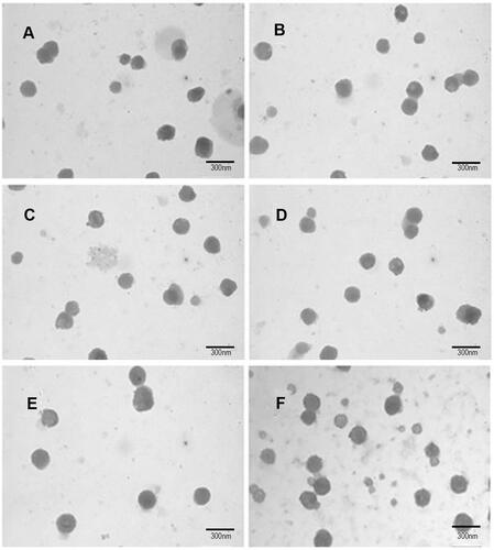 Figure 2 Morphology of different epirubicin liposomes observed by atomic resolution analytical transmission electron microscopy (×600). (A) Blank liposomes; (B) epirubicin liposomes; (C) epirubicin plus resveratrol liposomes; (D) epirubicin plus resveratrol liposomes; (E) epirubicin plus resveratrol liposomes modified with WGA; (F) epirubicin plus resveratrol liposomes modified with WGA and MAN.