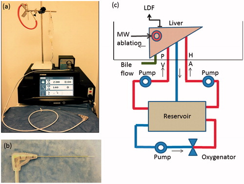 Figure 1. Microwave Ablation system and ex vivo perfusion system. (a) MWA system – Acculis MTA system® (AngioDynamics, Denmead, Hampshire). (b) MW applicator – Acc2i pMTA 14cm standard applicators (AngioDynamics, Denmead, Hampshire). (c) Ex vivo perfusion system –diagram showing the ex vivo perfused pig liver model. The perfusate was O-ve human blood (time expired) oxygenated using a mixed gas containing 14% O2, 5% CO2 and 81% N2 and warmed to 370 °C using the heat exchanger of the oxygenator. HA: Hepatic artery; PV: Portal vein; LDF: Laser Doppler Flowmetry; MW: Microwave.