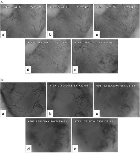 Figure 3. Typical images of tumor surfaces in (A) control and (B) LTSL-DOX-HT treated groups. In each group, the images show the network of tumor vasculature at (a) 0.5 h before treatment, and at (b) 0 h, (c) 6 h, (d) 24 h, and (e) 72 h after treatment.