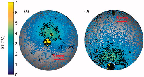 Figure 8. (A) Temperature elevation map with the antenna in the centre of the phantom, and (B) with the antenna positioned along the phantom periphery. In both cases, the antenna input power was set to 10 W and the temperature maps are shown after 5 min heating.