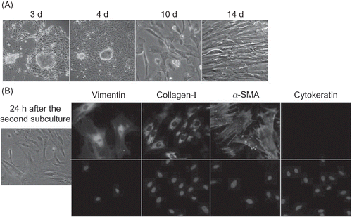Figure 1 Preparation of rat renal interstitial fibroblasts. (A) Light micrographs (200× magnification) showing rat renal interstitial fibroblast growth in primary culture. (B) Immunofluorescence analysis for identification of renal interstitial fibroblasts (400× magnification).