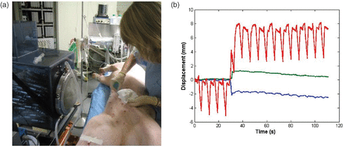 Figure 6. (a) In vivo investigation: the anesthetized pig is placed in front of the water cooling and coupling balloon of the 300-element system. (b) Real-time recording of the 3D respiratory motion using the HIFU array (red: superior-inferior motion, blue: lateral motion, green: anterior posterior motion).