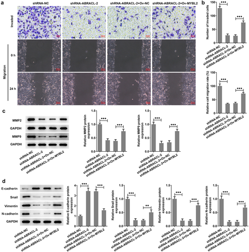 Figure 6. Overexpression of MYBL2 reverses the effects of ABRACL knockdown on the invasion, migration and EMT of breast cancer cells. (a) The invasive ability of MCF-7 cells transfected with shRNA-ABRACL-2 and Ov-MYBL2 was assayed by transwell experiment. (b) The migratory capacity of MCF-7 cells transfected with shRNA-ABRACL-2 and Ov-MYBL2 was determined by wound healing experiment. (c) The expression of MMP2 and MMP9 in MCF-7 cells transfected with shRNA-ABRACL-2 and Ov-MYBL2 was examined by means of western blot. (d) The expression of E-cadherin, Snail, Vimentin and N-cadherin in MCF-7 cells transfected with shRNA-ABRACL-2 and Ov-MYBL2 was tested employing western blot. **P < 0.01, ***P < 0.001.