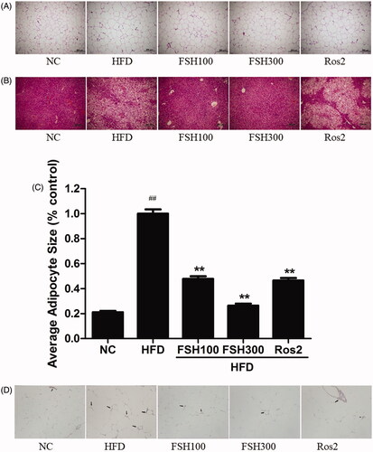 Figure 4. Histological analysis of epididymial WAT and liver tissue. (A) Photomicrographs of epididymal WAT stained with HE (100×). (B) Photomicrographs of liver tissues stained with HE (100×). (C) Adipocyte size (% control, n = 500; 100×). (D) Photomicrographs of epididymal white adipose tissues with F4/80 antibody. Values are expressed as mean ± S.E.M (n = 10). *p < 0.05, **p < 0.01, vs. HFD group, respectively; ##p < 0.01, vs. NC group.