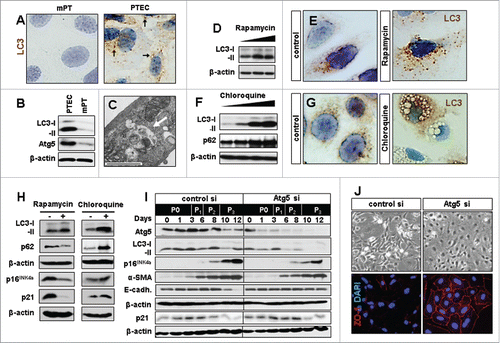 Figure 1. Experimental modification of baseline autophagy influences senescence marker expression and epithelial phenotype in renal primary tubular epithelial cells (PTEC). In vitro culturing of PTEC induces autophagy. (A) LC3 staining in mouse proximal tubular cells (mPT) cells and PTEC showing LC3 punctae (arrows) which are localized on the autophagosomal membrane during autophagy induction. (B) Representative LC3 immunoblots in PTEC as compared to mPT cells. (C) Electron microscopy image of PTEC with autophagic vacuoles representing baseline autophagy. (D) LC3 immunoblot in PTEC treated with increasing concentrations of rapamycin. (E) Immunocytochemistry for LC3 punctae upon autophagy induction with rapamycin. (F) Representative immunoblots for LC3 and p62 and (G) immunocytochemistry for LC3 aggregates and vacuole formation in PTEC upon autophagy inhibition with increasing concentrations of chloroquine. (H) Immunoblots for LC3, p62, p16INK4a and p21 at day 12 in PTEC treated with rapamycin and chloroquine. (I) Immunoblots for Atg5, LC3, p16INK4a, α-smooth muscle actin (α-SMA), E-cadherin (E-cadh.) and p21 in Atg5 or control siRNA treated PTEC harvested at indicated time points and passages (P0-P3). (J) Representative pictures of day 12 PTEC transfected with control or Atg5 siRNA in bright field and immunohistochemistry for epithelial marker ZO-1. Original magnification x 630 in A, E, and G and x 400 in J. Scale bar 1 µm in C. n = 3.