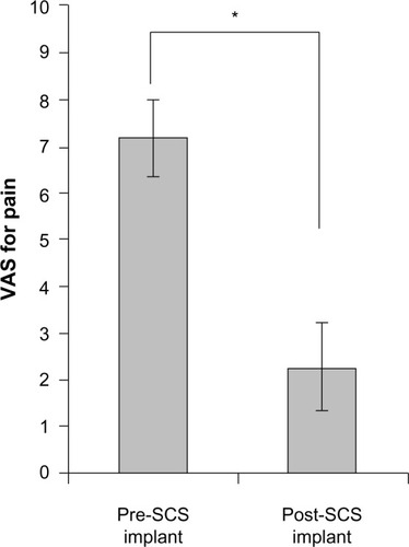 Figure 3 Mean LBP VAS scores recorded for pre- and post-SCS with paddle lead implantation.