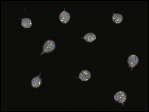 Figure 4  Cytogenetic assessment on spermatozoa by fluorescent in situ hybridization.