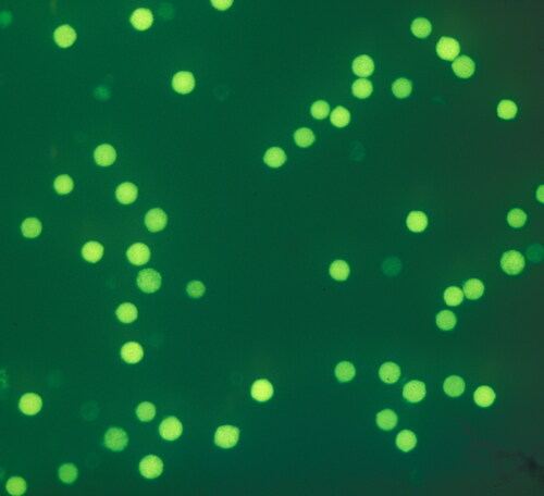 Figure 6. Pistachio pollen stained with FDA: viable pollen grains show bright fluorescence compared to non-viable pollen grains.