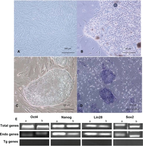 Figure 2 Generating iPS cells from HDF cells. A) The morphology of primary passage of human foreskin fibroblast (100X). B) Primary induced pluripotential stem cell colony (400X). C) iPS cells grown on irradiated MEFs (200X). D) Alkaline phosphatase staining of iPS cells (100X). E) The gene expression profiles of iPS cells by DNA electrophoresis.Notes: aThe iPS cells were generated based on Lipofectamine 2000; bThe iPS cells were generated based on dMNPs.Abbreviations: dMNPs, dendrimer-modified magnetic nanoparticles; HDF, human dermal fibroblast; iPS, induced pluripotent stem; MEF, mouse embryonic fibroblasts.