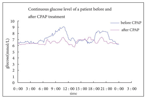 Figure 2 The changes of glucose level monitored by CGMS after CPAP treatment in subgroup D.