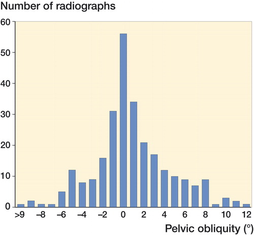 Figure 2. Number of pelvic radiographs related to the degree of PO. Negative value = left side of pelvis elevated, positive value = right side of pelvis elevated.