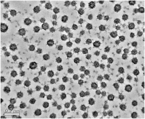 Figure 5. Transmission electron microscope (TEM) image of LL-NLCs.