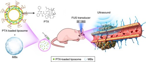 Figure 1 Schematic illustration outlining the delivery of PTX-LIPO using FUS exposure in the presence of circulating MBs.Notes: Stabilized long-circulating liposomes loaded with paclitaxel were co-injected with MBs through the tail vein of nude mice with intracranial glioblastoma xenografts. Low-intensity pulsed FUS sonication was applied to the GBM xenograft through the intact skull. PTX was delivered into the GBM tissue through the BTB disrupted by FUS with MBs.Abbreviations: BTB, blood–tumor barrier; FUS, focused ultrasound; GBM, glioblastoma multiforme; MBs, microbubbles; PTX, paclitaxel; PTX-LIPO, paclitaxel liposomes.