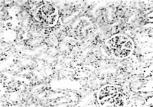 Figure 3 Kidney section of group 4 rat administered alcohol extract (250 mg/kg) showing mild glomerular and peritubular congestion. H & E. × 200.