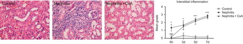 Figure 4.  Interstitial inflammation in rat kidneys during the experimental period and histological appearances of kidneys in control (grade 0, at sixth hour), nephritis (grade 4, on seventh day), and nephritis + CsA (grade 0, at sixth hour) groups. Values are expressed as mean ± SEM. n = 6 at each time point for each group. Notes: *Denotes p < 0.05 against control group, ***denotes p < 0.001 against control group. ns, not significant against control group. CsA, cyclosporine A.