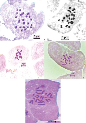 Figure 1. Somatic chromosomes of (a) Q. hartwissiana; (b) Q. frainetto; (c) Q. macranthera subsp. syspirensis; (d) Q. virgiliana; (e) Q. trojana.