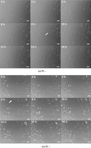 Figure 3.  Dynamical process of in vitro scratch assay with Hs68 cells in medium in the (a) absence or (b) presence of PL on the scratched well at 16 h of incubation. Scale bar = 100 µm.
