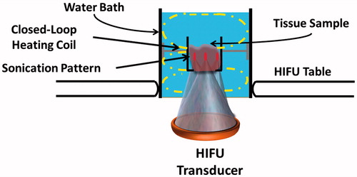 Figure 1. Experimental setup to produce lesions in ex vivo tissues on a clinical MR-HIFU system. The setup consisted of a water bath, filled with degassed water and a closed-loop heating coil that circulated heated water to maintain the water bath temperature at 37.5 °C. A custom-designed tissue holder was positioned at a fixed distance from the transducer. The water bath was placed on the patient tabletop’s acoustic window. Each tissue sample (45 mm in thickness) was sonicated using a 3 × 3 grid pattern with 1 mm spacing between foci in either direction.