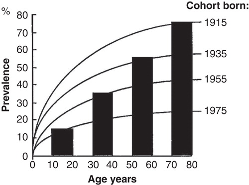 Figure 6. A computer simulation to demonstrate the “birth cohort phenomenon” in prevalence of Helicobacter pylori gastritis in a population consisting of cohorts with dissimilar birth years. Approximated from data on gastritis in Finland around the late 80s (see Figure 4).